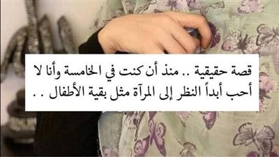 قصة القبيحة قصة حقيقية حزينة مؤثرة